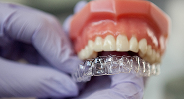 Şeffaf Plaklarla Dişlerin Düzeltilmesi